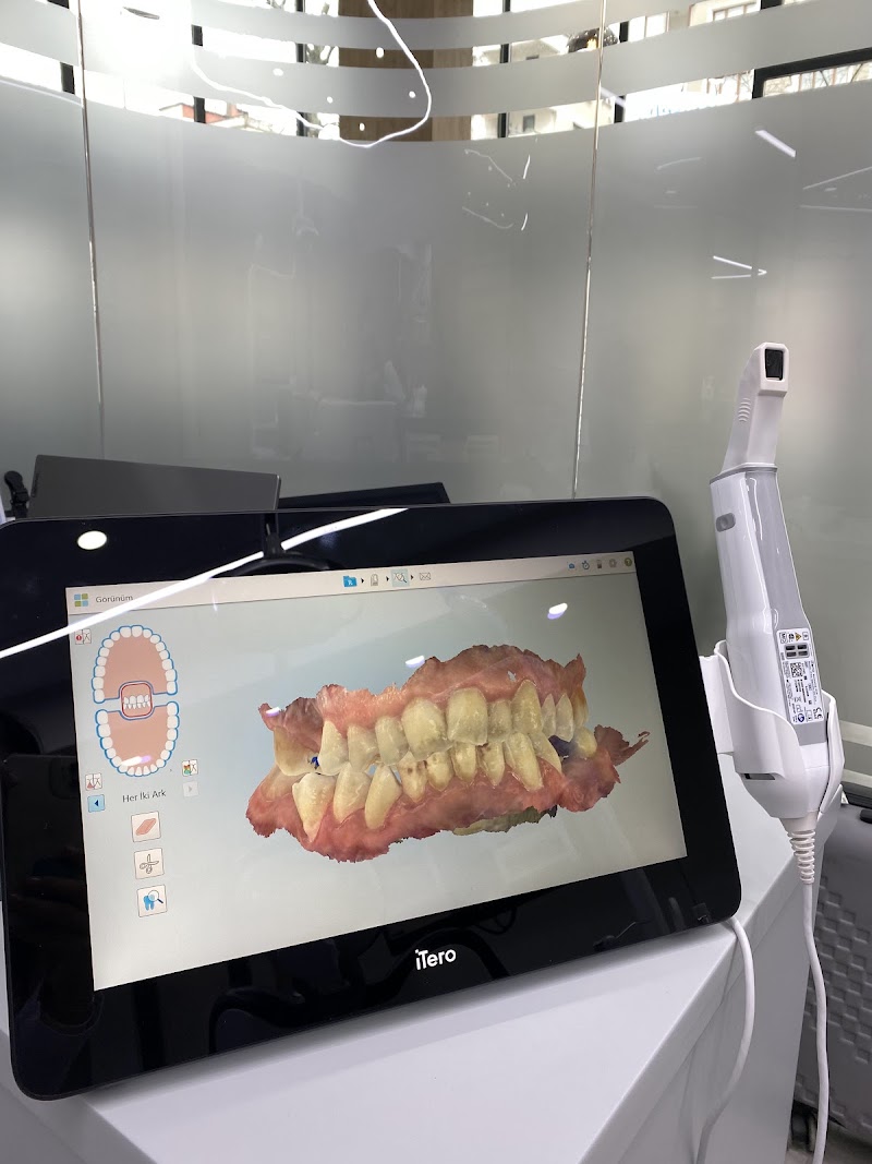 Dentbien Ağız ve Diş Sağlığı Polikliniği / Ataşehir İmplant Diş Kliniği